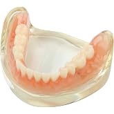 Dental Model Overdenture Inferior 2 Implants Demo Detachable (Lower Jaw) | Resin Transparent Model for Classroom Demonstration,Education and Study