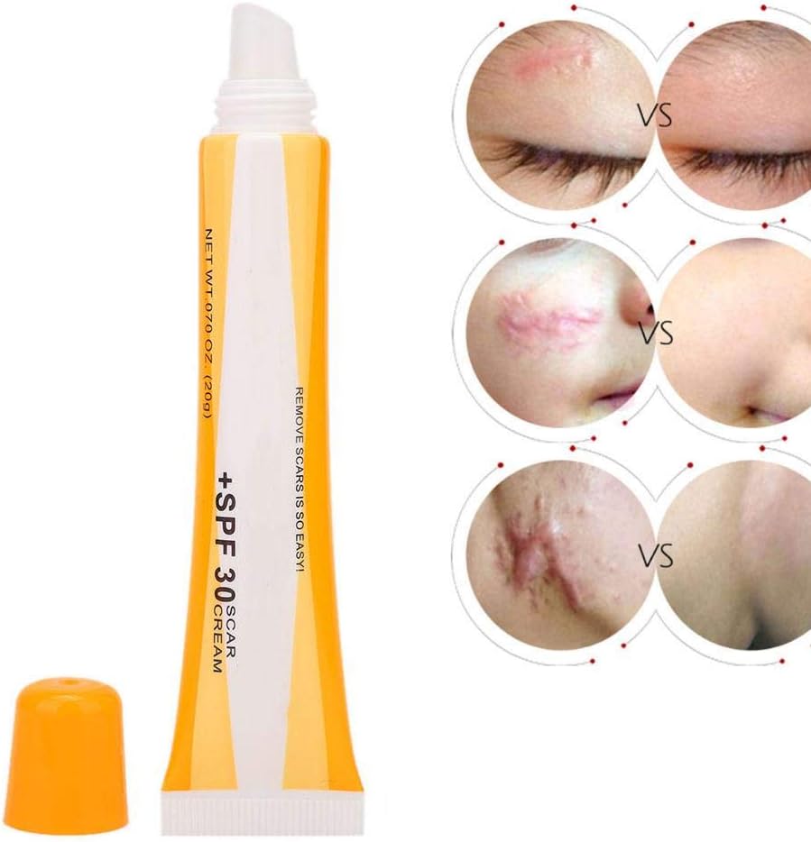 Scar Removal Gel, 20g Skin Repair Acne Surgical Mark Removal Cream Scar Skin Care Cream Repair Wound Nourishing Skin Repair During Pregnancy(yellow)