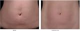 Palmers Cocoa Butter Formula with Vitamin E Skin Therapy Oil 150ml 5.1fl oz view 5