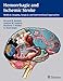 Hemorrhagic and Ischemic Stroke: Medical, Imaging, Surgical and Interventional Approaches by Bernard Bendok, Andrew M. Naidech