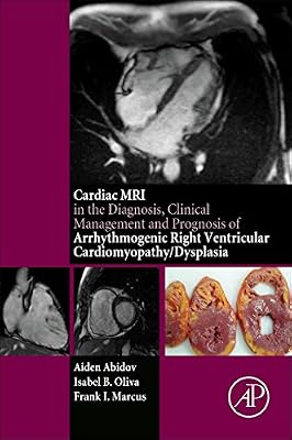 Cardiac Mri In Diagnosis Clinical Management And Prognosis Of
