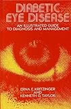 Diabetic Eye Disease, Kritzinger, Erna E. and Taylor, Kenneth G., 0852007361