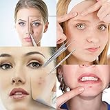 Blackhead & Splinter Remover Tools - Stainless Steel Professional Easily Cure Pimples Whiteheads Comedones Acne Zit Ingrown Hairs and Facial Impurities Bend Head Tweezer Surgical Kit by FIXBODY