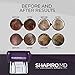 Hair Loss Shampoo and Conditioner | All-Natural DHT Blockers for Thinning Hair Developed by Dermatologists | Experience Healthier, Fuller & Thicker Looking Hair - Shapiro MD | 1-Month Supply