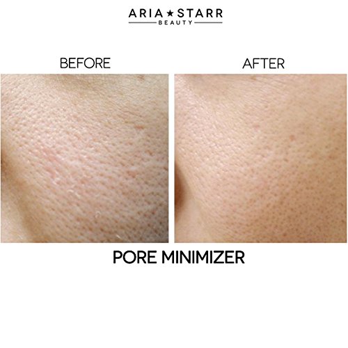 Aria Starr Anti Acne Treatment Serum & Pores Minimizer BEST For Face