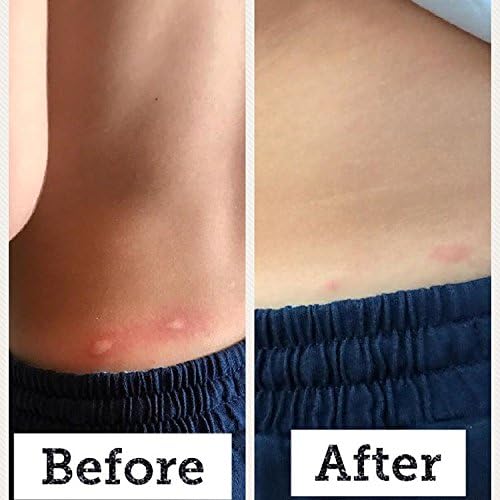 babybiotics topical probiotic body care