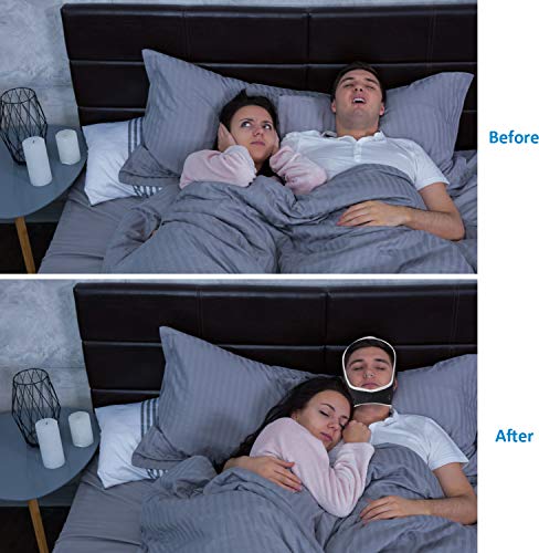 image for KUYANG Anti Snoring Devices - Snoring Solution - Snore Stopper Set - A