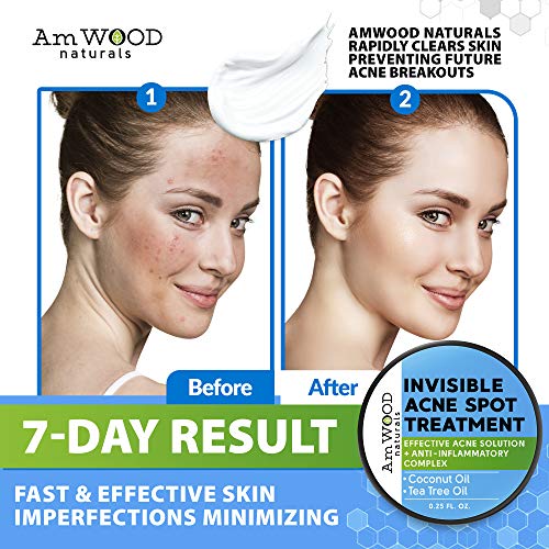 Acne Spot Treatment Cream - Made in USA - Fast-Acting Formula for Clearing Severe Acne from Face & Body - Effective & Invisible Cystic Acne Cleanser Solution for Teens & Adults