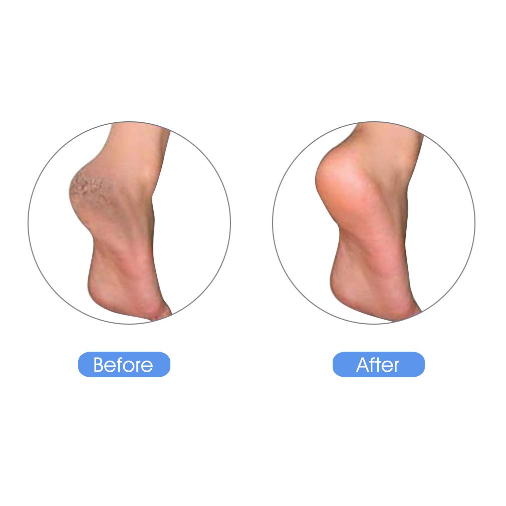 KuuCare Pumice Stone for Feet, Natural Earth Lava Pumice Stone - Foot File Callus Remover for Feet Heels, Pedicure Exfoliator for Dead Skin, Hard Skin and Foot Scrubber: Beauty