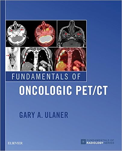 Amazon Com Fundamentals Of Oncologic Pet Ct E Book Fundamentals