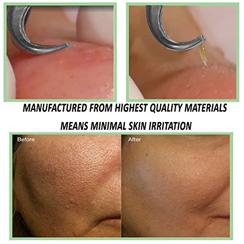 FEITA Blackhead Remover Pimples Comedones Splinter Extractors Tweezers Surgical Skin Care Cleaning Tools for Acnes Whiteheads Blemishes Zits Ingrown Hairs(5pcs)