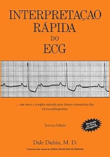 Interpretação Rápida do ECG