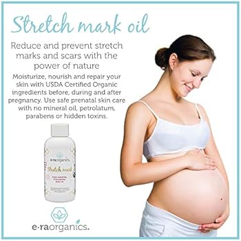organic stretch mark removal