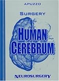Surgery of the Human Cerebrum, , 160547133X