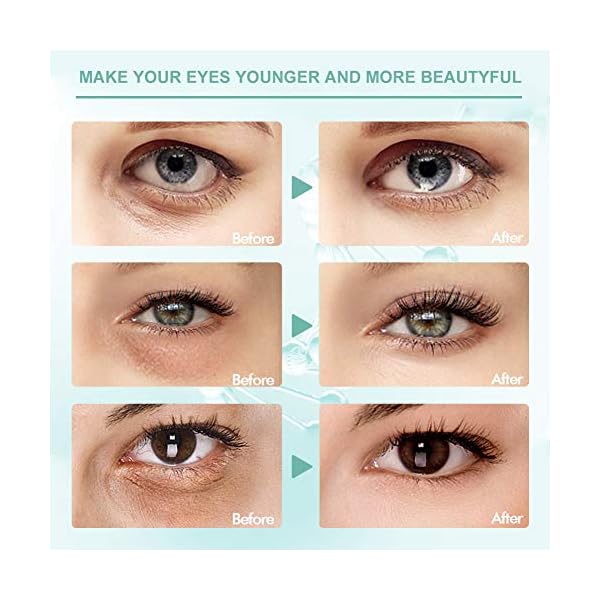 Under-Eye-Mask-Collagen-Eye-Mask-Anti-Aging-Eye-Patch-Collagen-Eye-pads-Eye-Treatment-Mask-for-Puffy-Eyes-Bags-Dark-Circles-and-Wrinkleswith-Collagen-Hyaluronic-Acid-Hydrogel Under Eye Mask, Collagen Eye Mask, Anti Aging Eye Patch, Collagen Eye pads, Eye Treatment Mask, for Puffy Eyes & Bags…