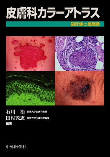 皮膚科カラーアトラス 臨床像と組織像 9784498063365 Amazon Com Books
