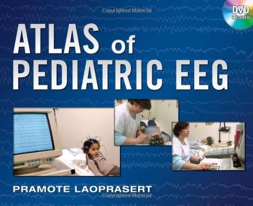 ATLAS OF PEDIATRIC EEG
