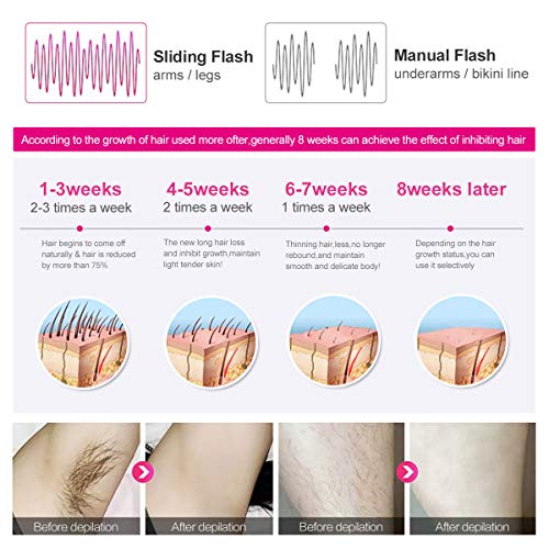 TOPLANET IPL Hair Removal for Women 500000 Flashes Permanent Body Hair Remover Home Using Auto Flash for Bikini line, Legs, Arms, Armpits Wholebody