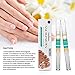 Fungus Stop, Fungus Treatment, Anti Fungus Nail Treatment, Effective Against Nail Fungus, Anti Fungal Nail Solution, Toenails&Fingernails Solution,Removes Yellow from Infected Finger & Toe Nails,2pcs