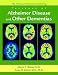 American Psychiatric Publishing Textbook of Alzheimer's Disease and Other Dementias: The App Textboo by 