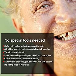 Temporary Tooth Repair Beads For Missing Tooth