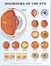 Disorders of The Eye Anatomical Chart