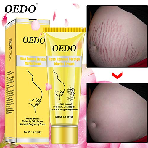 oedo rose remove stretch marks