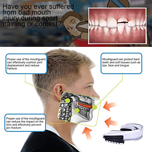 AiBOB Sport Mouth Guard Kids Youth/Adults 2pcs (White, Adults (11 yrs & Above))