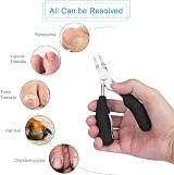 URAQT Toenail Clippers 4 Pcs Nipper Trimmer Kit with Nail File Nail Lifter Duo view 7
