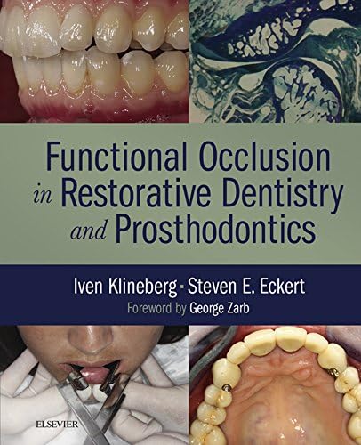 Amazon.com: Functional Occlusion: From TMJ to Smile Design eBook