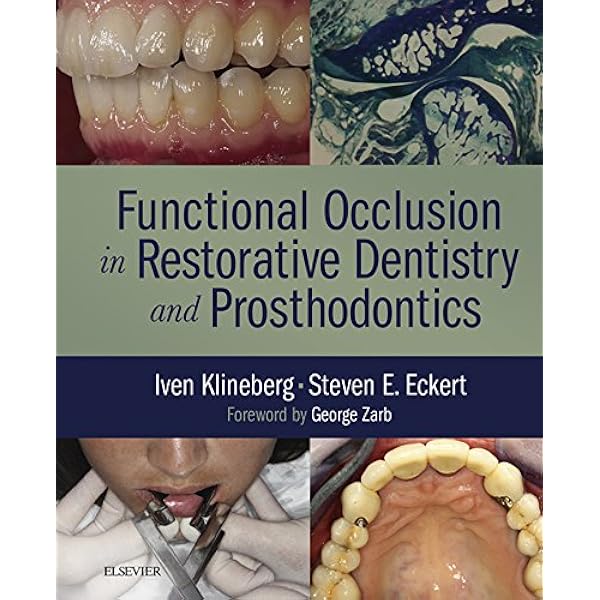 Amazon.com: Practical Applications in Dental Occlusion: Analog to