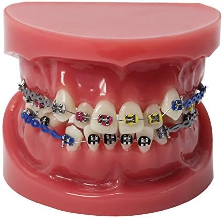 New Teeth Malocclusion Correct and Brackets Teeth Hoop Standard Simulation Model M3005