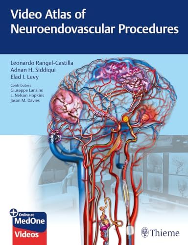 健康・医学 Decision Making in Neurovascular Disease Decision Making in Neurovascular Disease: 9781684200573: Medicine