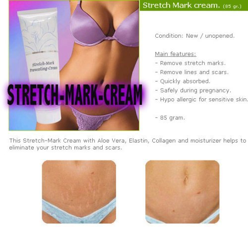 giffarine stretch mark cream