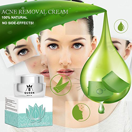 most effective acne cream