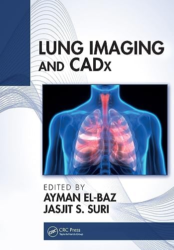 Thoracic Imaging: A Core Review: 9781496347480: Medicine & Health
