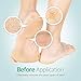 Foxi Fresh 2-Sided Diamond Coated Foot Scrubber Callus Remover Foot File Foot Care
