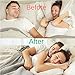 Mouth Guard-Anti Snoring Devices-Sleep Aid-Snore Stopper Solution w/Chin Strap/Mouthpiece/Nasal Aspirator Nose Vents. 3-in-1 Device Aids/Mute/Stop/Relief Snoring/Teeth Grinding 2 Snore No More
