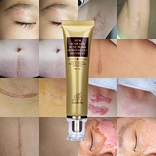 black skin scar removal cream