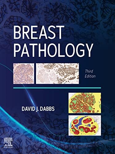 Amazon.com: Diagnostic Histopathology of Tumors E-Book: Expert