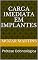 Livro Carga Imediata em Implantes: Prótese Odontológica