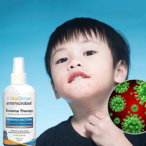 SkinSmart Eczema Therapy Removes Bacteria so Skin Can Heal, 8 Ounce Clear Spray and Safe for Babies, Kids, Adults and Seniors