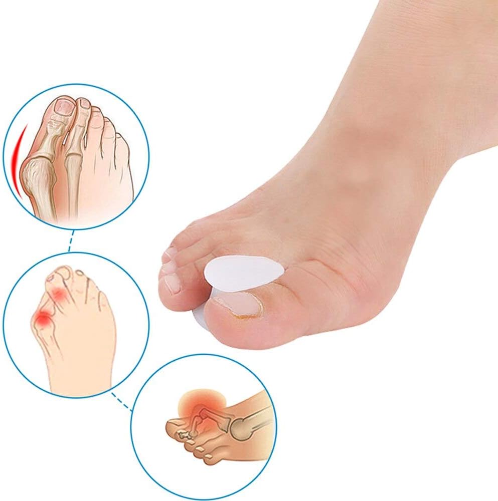 Pedimend Silicone Gel Toe Separator, Big Toe Straightener, Toe Separator for Bunion and Hallax Valgus Problems - Image 4