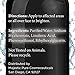 Majestic Pure Serum with Hyaluronic Acid for Face & Skin - Moisturizing and Serum - Reduces Dark Spots, Improves Complexion - 1 fl oz
