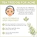 ArtNaturals 100% Pure Tea Tree Essential Oil - (.5 Fl Oz / 15ml) - Natural Premium Melaleuca Therapeutic Grade - Great with Soap and Shampoo, Face and Body Wash - Treatment for Acne, Lice