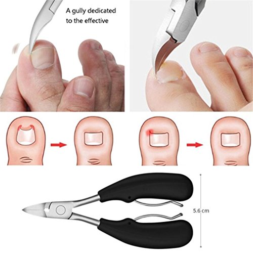 AutumnFall Foot Care Tool,2Pcs Ingrown Toe Nail Correction Nippers Clipper Cutters Dead Skin Dirt Remover + Paronychia Podiatry Pedicure Care Tool Set (Silver) (Blue)