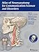 Atlas of Neuroanatomy for Communication Science and Disorders