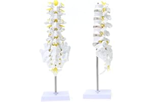 RONTEN Life Size Lumbar Spine Anatomical Model with A Herniated Disc at L4, Lumbar Spine Model with Sacrum and Spinal Nerves