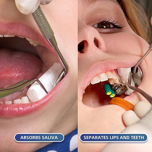 NALACAL 400 PCS Dental Gauze Rolls Cottons Pads, Nosebleed Kit Accessories #2 Medium 1.5" Mouth Gauze Nose Plugs for Dental Clinic, Household
