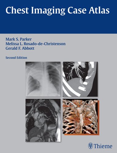 CHEST IMAGING CASE ATLAS